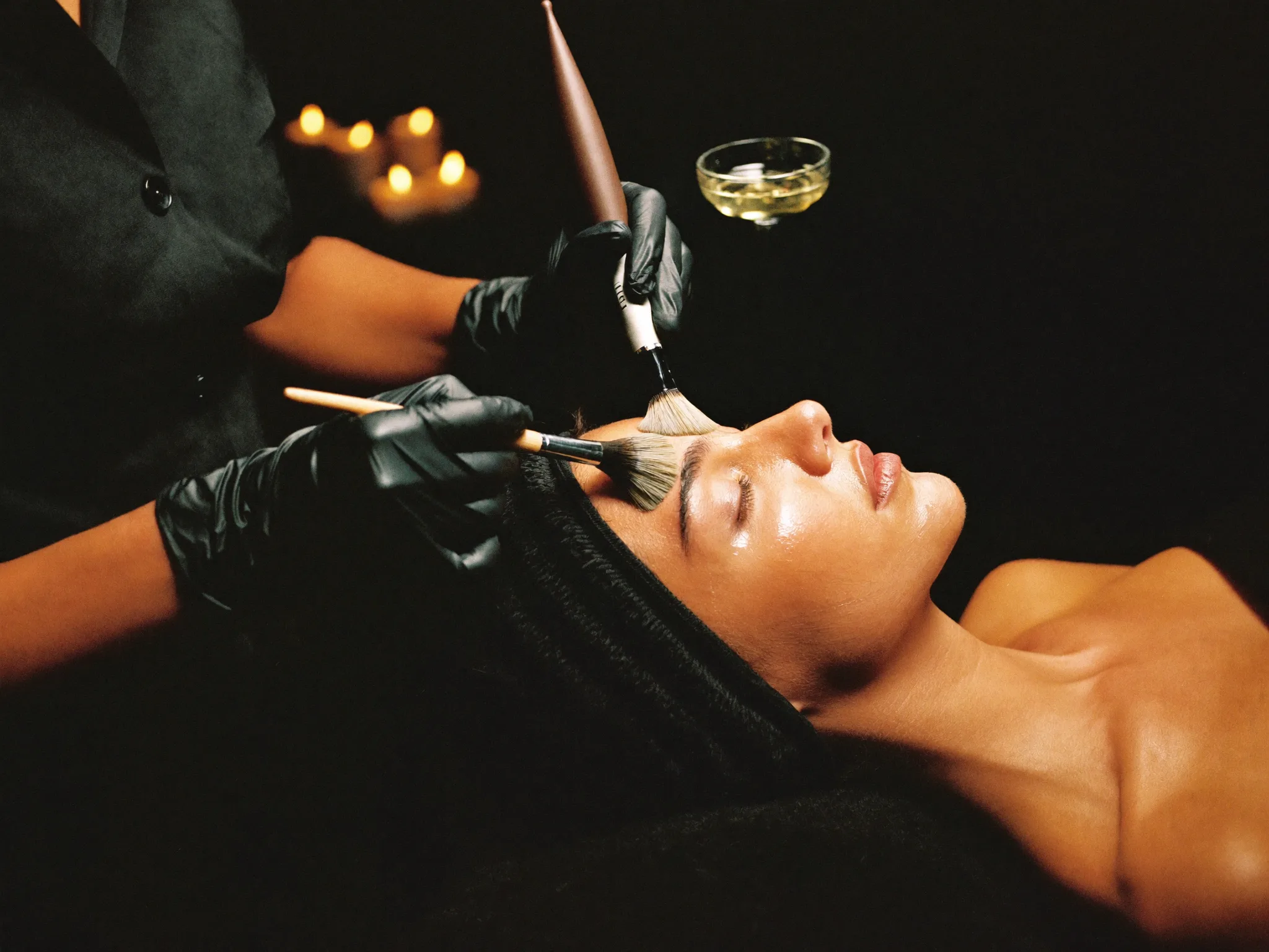 Chemical Peels