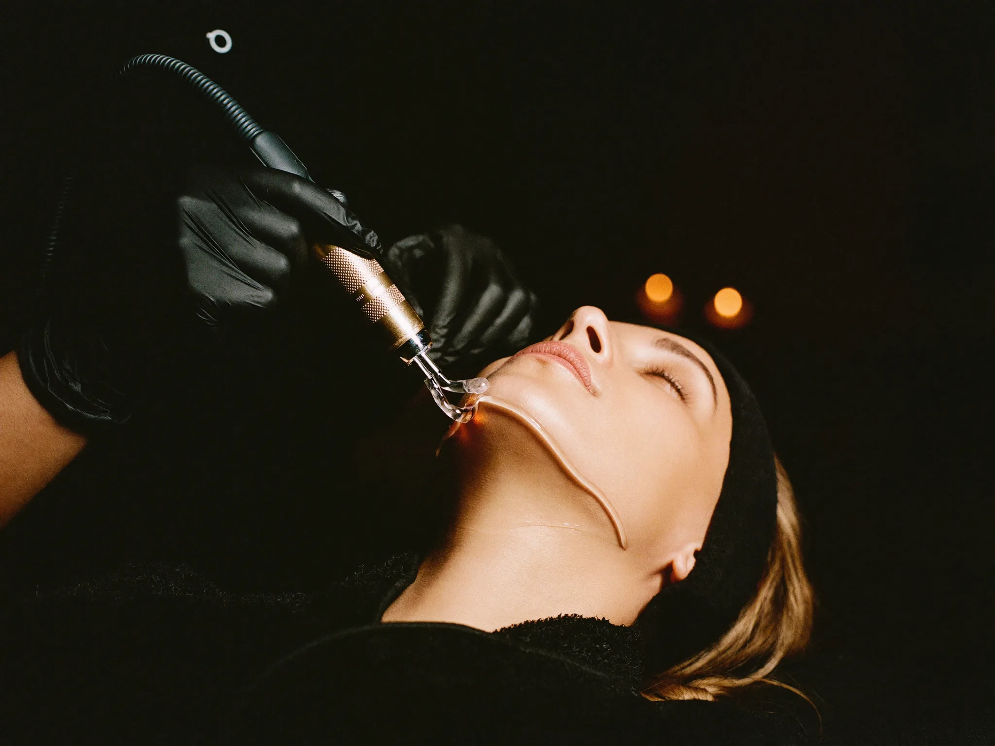 RF Facial Contouring in London: A Sharper Jawline, No Needle